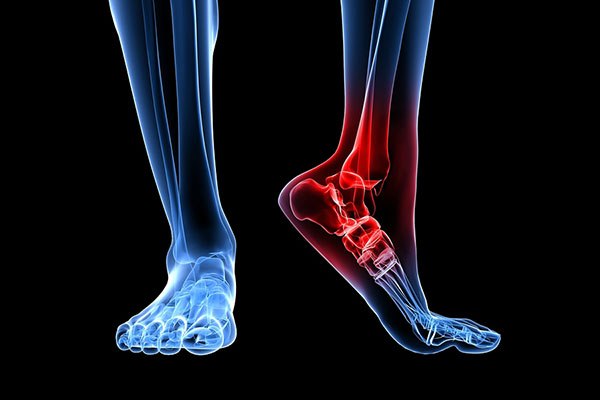 足裏のしびれ 足根管症候群の原因 症状 治療方法の全知識