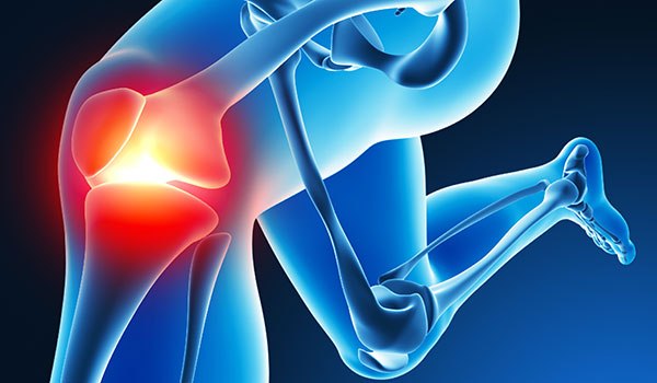 膝の前十字靭帯損傷 Acl の症状 治療 テーピング リハビリ 全知識 膝の前十字靭帯損傷 Acl の症状 治療 テーピング リハビリ 全知識