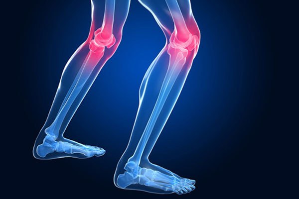 膝の内側側副靱帯 Mcl 損傷の症状 治療 テーピング リハビリ全知識